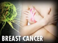 breast cancer