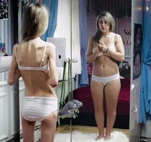 Chained to an Eating Disorder