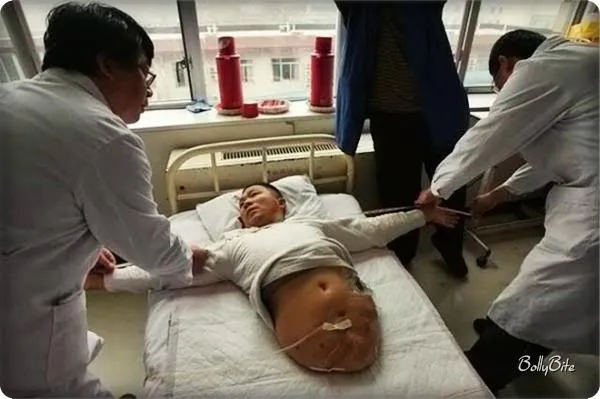 Overcoming Challenges: The Peng Shuilin Story