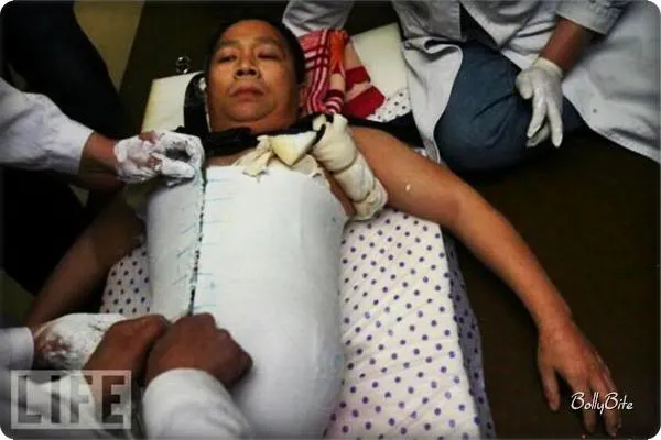 Overcoming Challenges: The Peng Shuilin Story